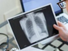 En San Antonio buscan combatir la tuberculosis con ex&aacute;menes preventivos